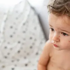 Czy dziecko zaszczepione na ospę może zachorować? Sprawdź, co musisz wiedzieć